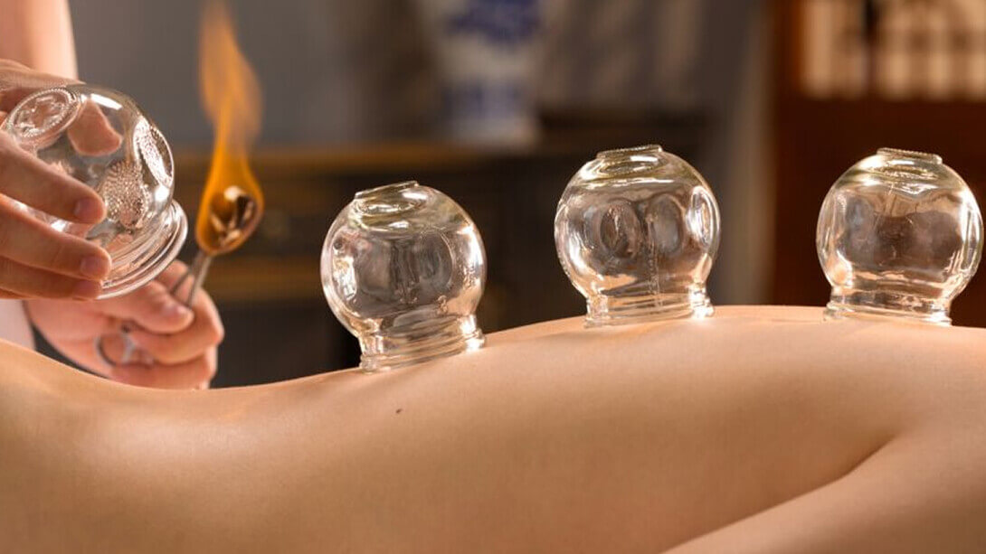Best Cupping