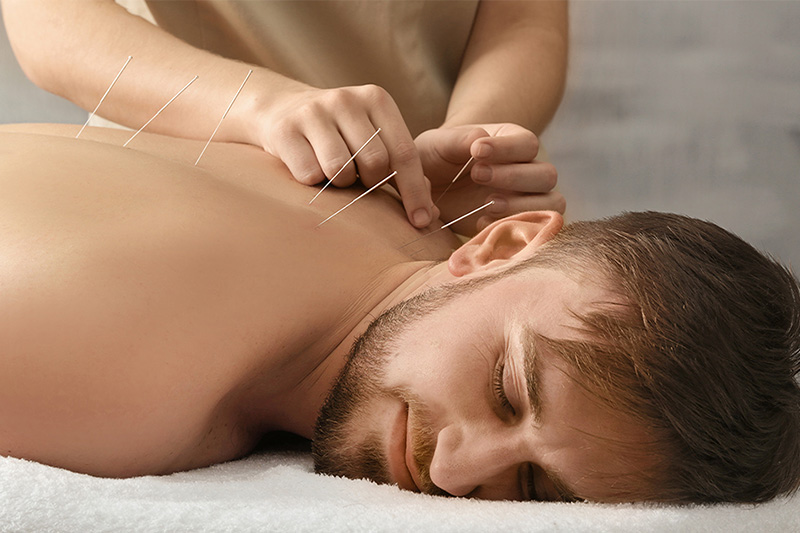 Acupuncture Therapy back shoulder